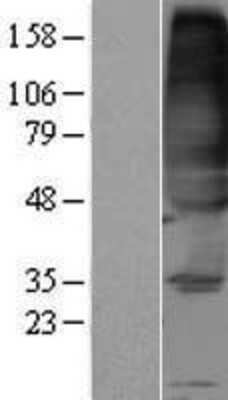 Western Blot: FVT1 Overexpression Lysate [NBP2-10794]