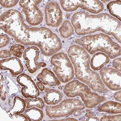 Immunohistochemistry-Paraffin: FXC1 Antibody [NBP2-14031]