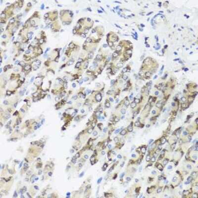Immunohistochemistry-Paraffin: FXC1 Antibody - BSA Free [NBP3-03225]