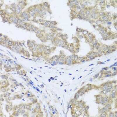 Immunohistochemistry-Paraffin: FXC1 Antibody - BSA Free [NBP3-03225]