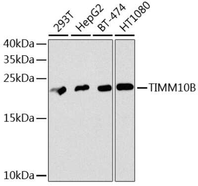 Immunohistochemistry-Paraffin: FXC1 Antibody - BSA Free [NBP3-03225]