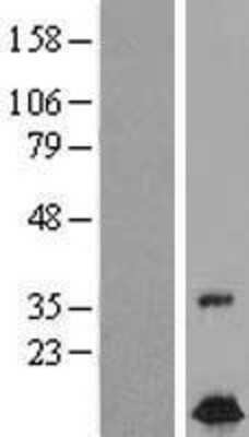 Western Blot: FXC1 Overexpression Lysate [NBL1-10870]