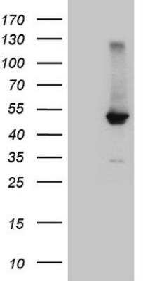 Western Blot: FXR/NR1H4 Antibody (OTI4F12) [NBP2-46221]