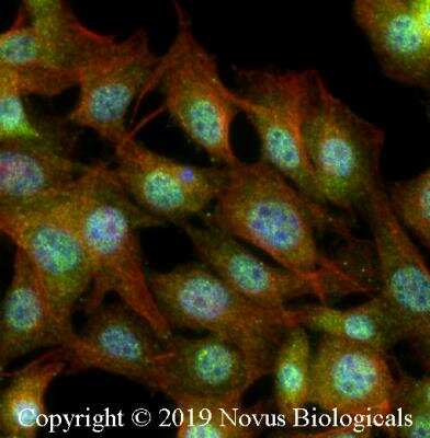 Immunocytochemistry/ Immunofluorescence: FXR/NR1H4 Antibody [NB400-153]