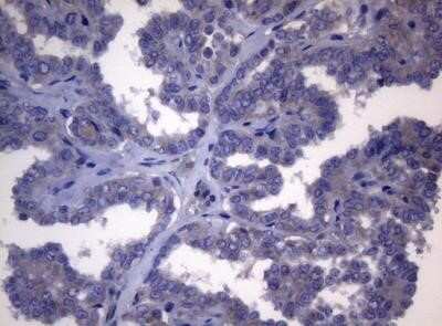 Immunohistochemistry: FXR/NR1H4 Antibody (OTI4F12) - Azide and BSA Free [NBP2-71526]
