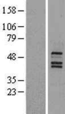 Western Blot: FXR/NR1H4 Overexpression Lysate [NBL1-13769]