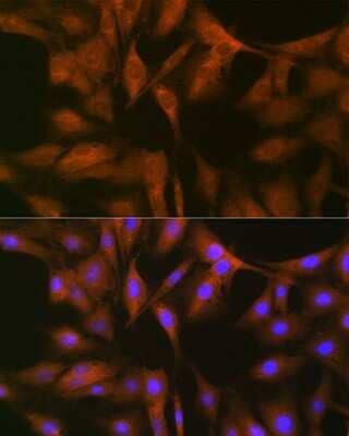 Immunocytochemistry/ Immunofluorescence: FXR1 Antibody (2S2B1) [NBP3-16681]