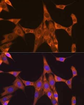 Immunocytochemistry/ Immunofluorescence: FXR1 Antibody (2S2B1) [NBP3-16681]