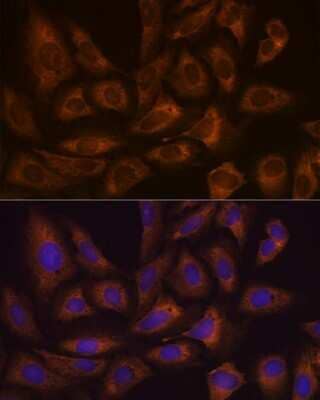 Immunocytochemistry/ Immunofluorescence: FXR1 Antibody (2S2B1) [NBP3-16681]