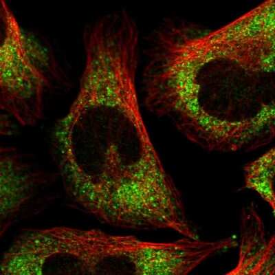 Immunocytochemistry/ Immunofluorescence: FXR1 Antibody [NBP2-56217]