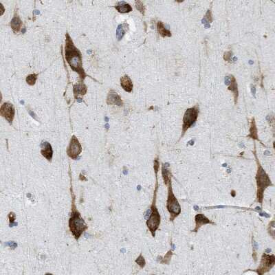 Immunohistochemistry-Paraffin: FXR1 Antibody [NBP1-89546]