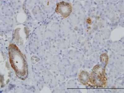 Immunohistochemistry-Paraffin: FXYD2 Antibody (1C3-B3) [H00000486-M01]