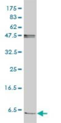 Western Blot: FXYD2 Antibody (1C3-B3) [H00000486-M01]