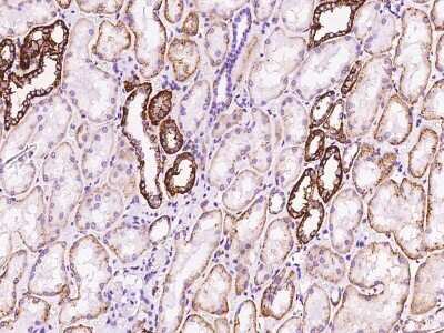 Immunohistochemistry: FXYD2 Antibody [NBP2-97415]