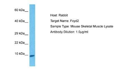 Western Blot: FXYD2 Antibody [NBP2-87476]