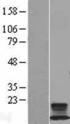 Western Blot: FXYD2 Overexpression Lysate [NBL1-10877]