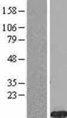 Western Blot: FXYD2 Overexpression Lysate [NBL1-10878]