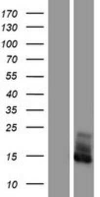 Western Blot: FXYD2 Overexpression Lysate [NBP2-09449]