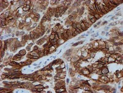 Immunohistochemistry-Paraffin: FXYD3 Antibody (OTI4E3) [NBP2-01991]