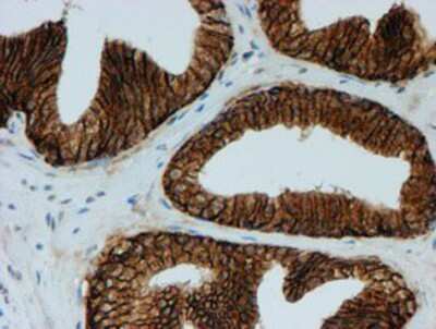 Immunohistochemistry-Paraffin: FXYD3 Antibody (OTI4E3) [NBP2-01991]