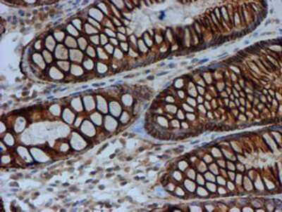 Immunohistochemistry-Paraffin: FXYD3 Antibody (OTI4E3) [NBP2-01991]
