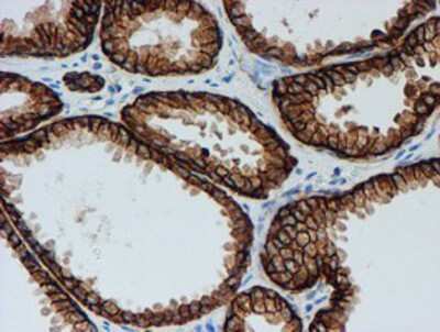 Immunohistochemistry-Paraffin: FXYD3 Antibody (OTI4E3) [NBP2-01991]