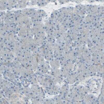 Immunohistochemistry-Paraffin: FXYD3 Antibody [NBP1-81256]