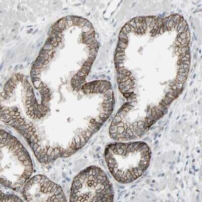 Immunohistochemistry-Paraffin: FXYD3 Antibody [NBP1-81256]