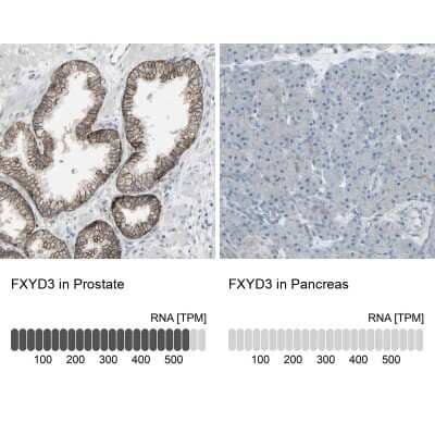 Immunohistochemistry-Paraffin: FXYD3 Antibody [NBP1-81256]