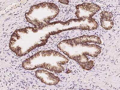 Immunohistochemistry-Paraffin: FXYD3 Antibody [NBP2-98625]