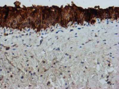 Immunohistochemistry: FXYD3 Antibody (OTI4E3) - Azide and BSA Free [NBP2-71219]