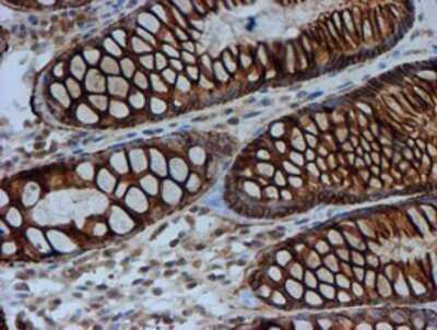 Immunohistochemistry: FXYD3 Antibody (OTI4E3) - Azide and BSA Free [NBP2-71219]