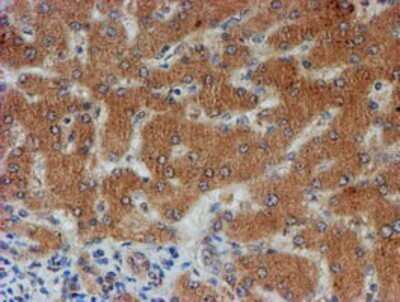 Immunohistochemistry: FXYD3 Antibody (OTI4E3) - Azide and BSA Free [NBP2-71219]