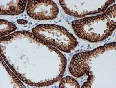 Immunohistochemistry: FXYD3 Antibody (OTI4E3) - Azide and BSA Free [NBP2-71219]