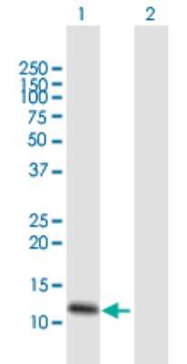 Western Blot: FXYD3 Antibody [H00005349-B01P]