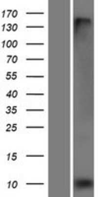 Western Blot: FXYD3 Overexpression Lysate [NBP2-06503]