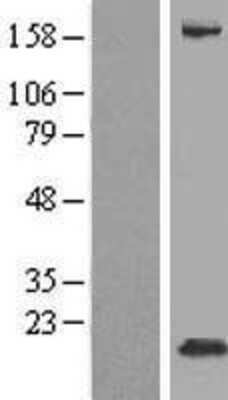 Western Blot: FXYD3 Overexpression Lysate [NBP2-07685]