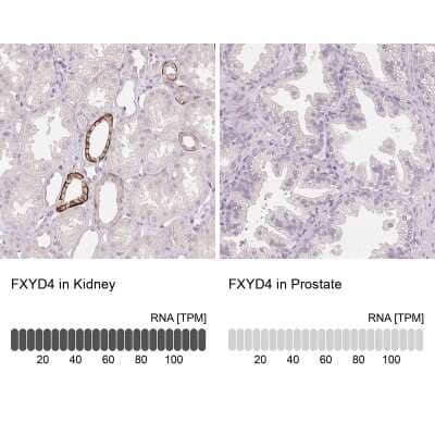 Immunohistochemistry: FXYD4 Antibody [NBP2-48725]