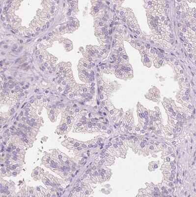 Immunohistochemistry: FXYD4 Antibody [NBP2-48725]