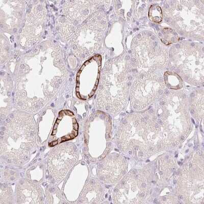 Immunohistochemistry-Paraffin: FXYD4 Antibody [NBP2-48725]