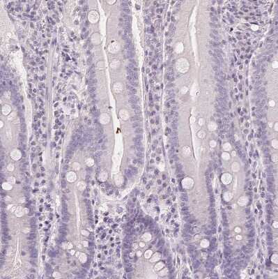 Immunohistochemistry-Paraffin: FXYD4 Antibody [NBP2-48725]