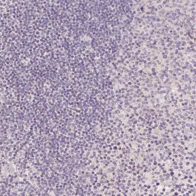 Immunohistochemistry-Paraffin: FXYD4 Antibody [NBP2-48725]