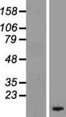 Western Blot: FXYD4 Overexpression Lysate [NBL1-10879]