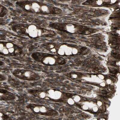 Immunohistochemistry-Paraffin: FXYD5/Dysadherin Antibody [NBP1-82486]
