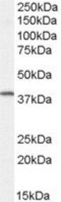 Western Blot: FXYD5/Dysadherin Antibody [NB100-1003]