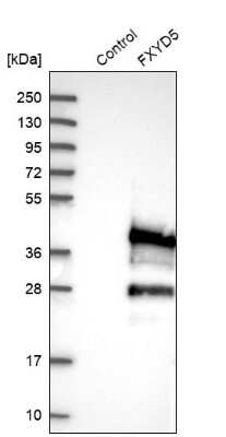 Western Blot: FXYD5/Dysadherin Antibody [NBP1-82486]