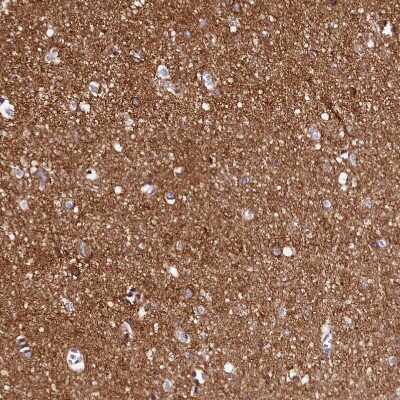 Immunohistochemistry-Paraffin: FXYD6 Antibody [NBP1-91915]