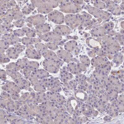 Immunohistochemistry-Paraffin: FXYD6 Antibody [NBP1-91915]