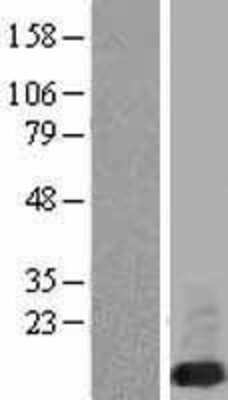 Western Blot: FXYD6 Overexpression Lysate [NBL1-10881]