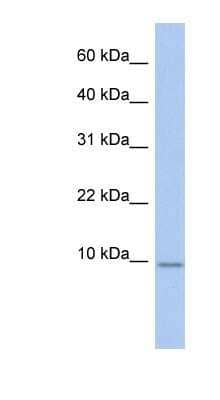 Western Blot: FXYD7 Antibody [NBP1-80082]